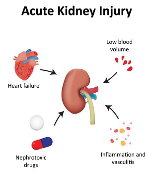 Failure kidney of signs acute Acute Kidney