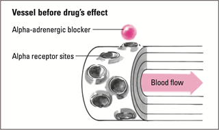 Vessel-Before-Drug.png