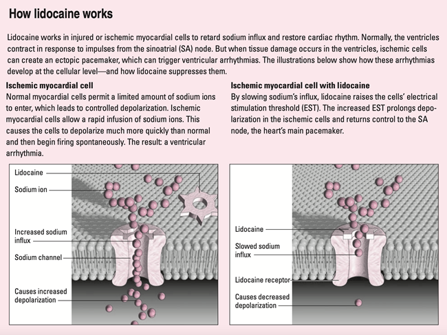 How-Lidocaine-Works-(1).png