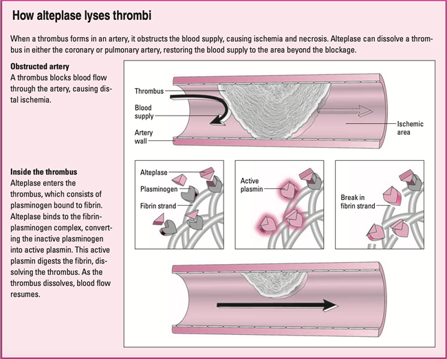 Alteplase-How-It-works-(1).png