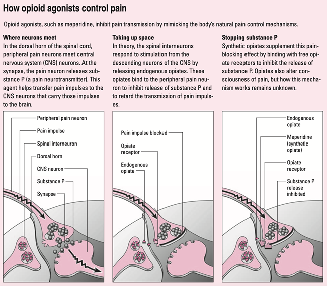 How-Opioid-Agonists-Work-(1).png