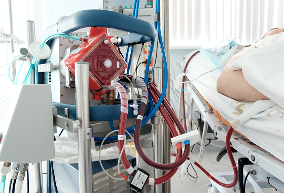 Basics of extracorporeal membrane oxygenation (ecmo) | nursingcenter