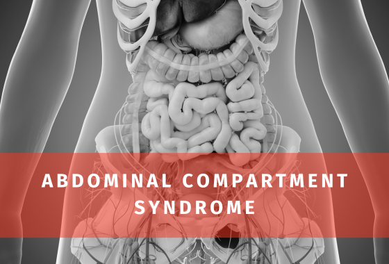 Abdominal Compartment Syndrome