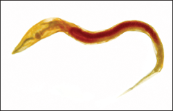 Giardiasis decaris Nitazoxanide pinworms