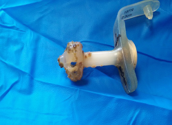Nursing Care And Management Of Gastrostomy And Gastojejunostomy Tubes In The Pediatric Population Ce Article Nursingcenter
