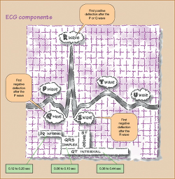 Figure. ECG componen... - Click to enlarge in new window